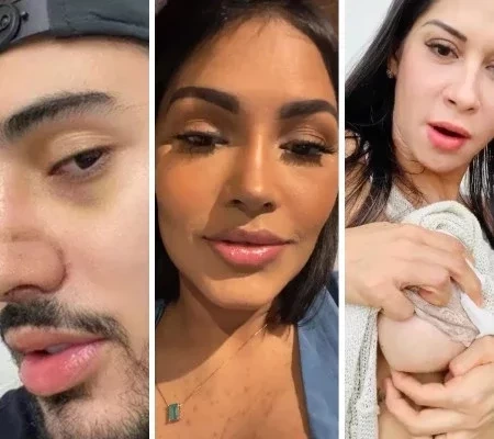 Famosos aproveitam a quarentena para fazer plásticas; veja fotos