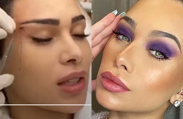 Famosos aproveitam a quarentena para fazer plásticas; veja fotos - imagem 22295