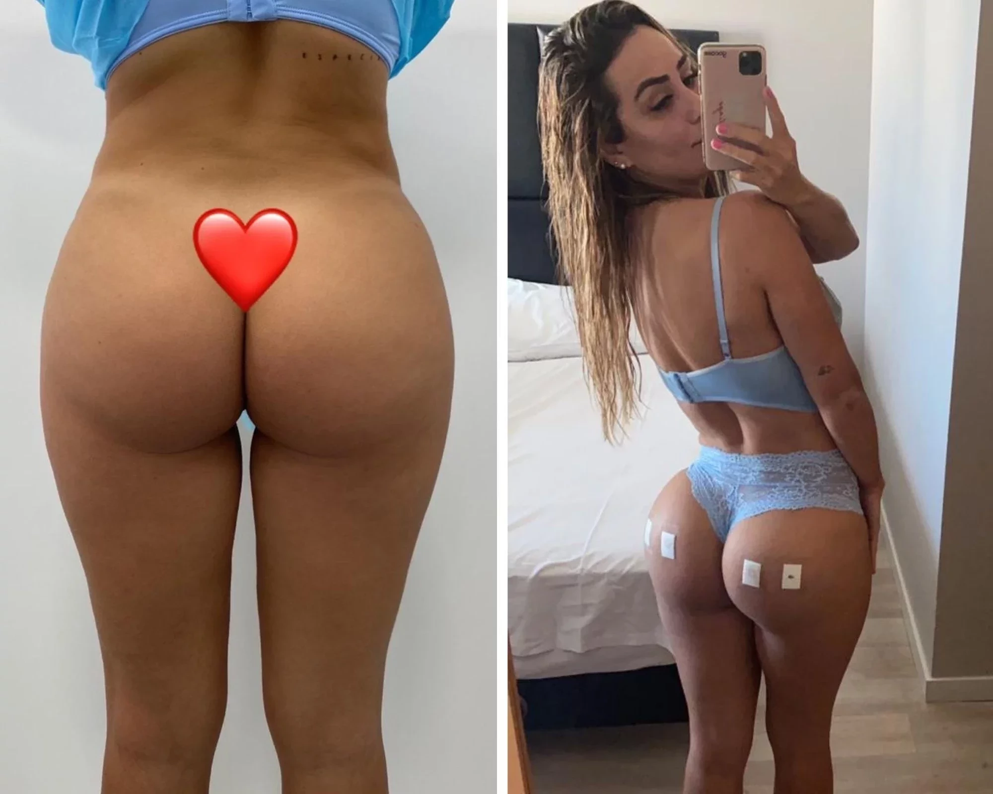 Famosos aproveitam a quarentena para fazer plásticas; veja fotos - imagem 22297