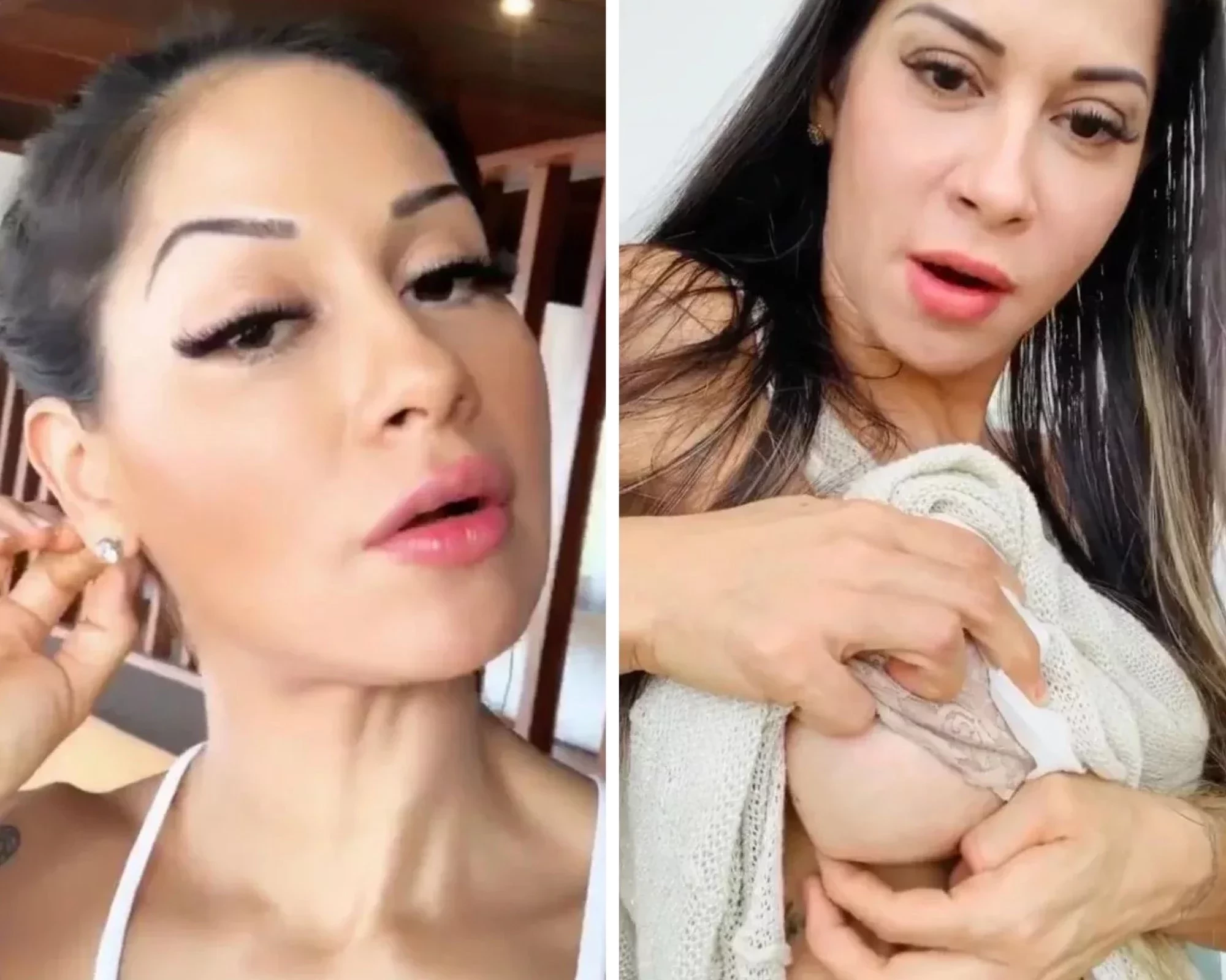 Famosos aproveitam a quarentena para fazer plásticas; veja fotos - imagem 22291