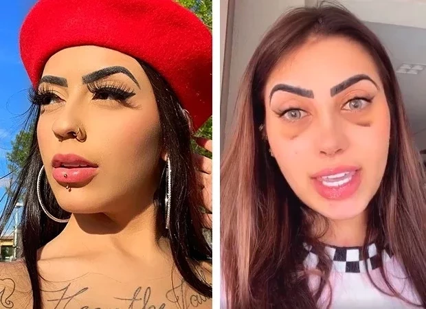 Famosos aproveitam a quarentena para fazer plásticas; veja fotos - imagem 22294