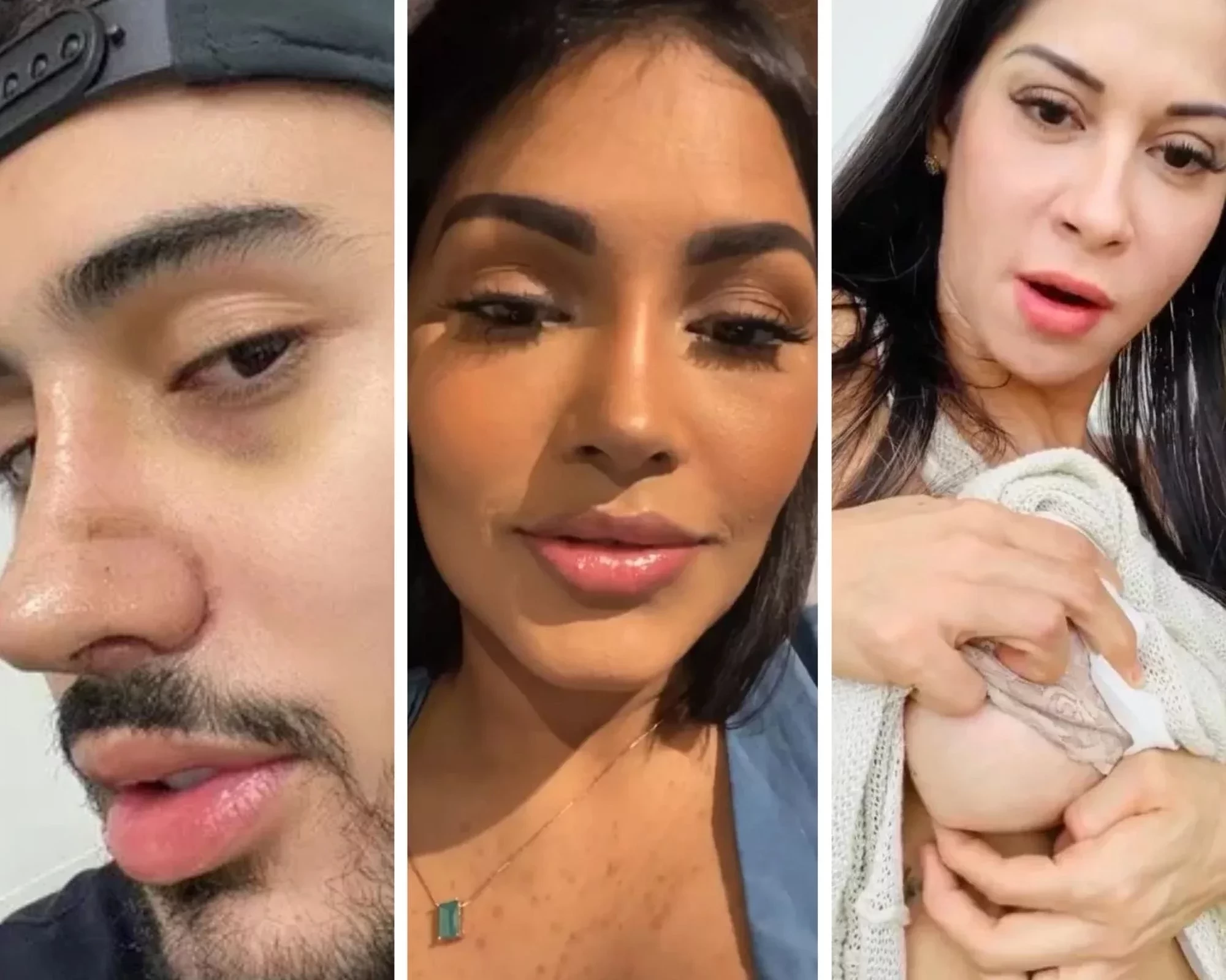 Famosos aproveitam a quarentena para fazer plásticas; veja fotos - imagem 22289