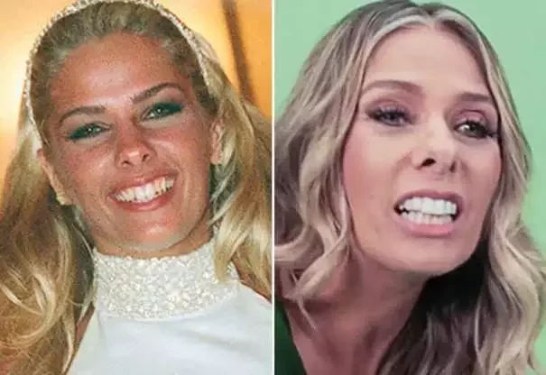 Diga xis! Confira o antes e depois do sorriso das celebridades  - imagem 21404