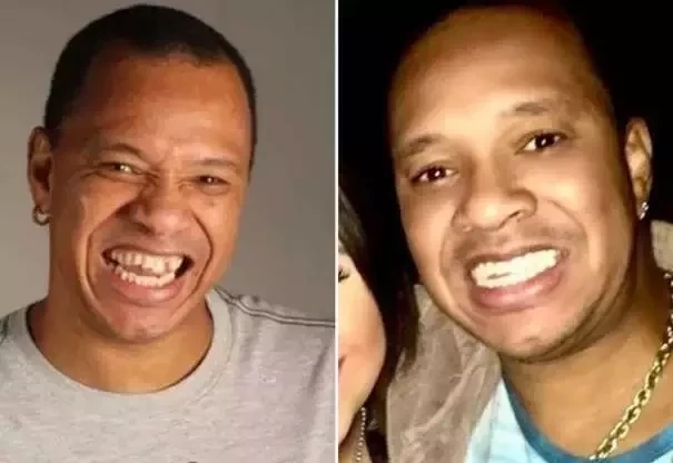 Diga xis! Confira o antes e depois do sorriso das celebridades  - imagem 21407