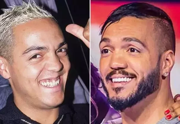 Diga xis! Confira o antes e depois do sorriso das celebridades  - imagem 21406