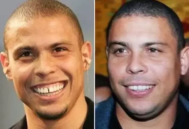 Diga xis! Confira o antes e depois do sorriso das celebridades  - imagem 21403