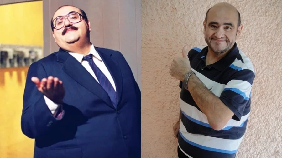 Veja o Antes e Depois de 15 famosos que perderam peso após cirurgia - imagem 23321