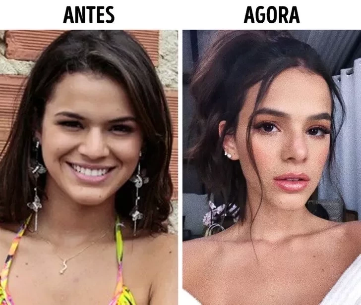 Confira o Antes e Depois das cirurgias plásticas de 15 famosas - imagem 22851