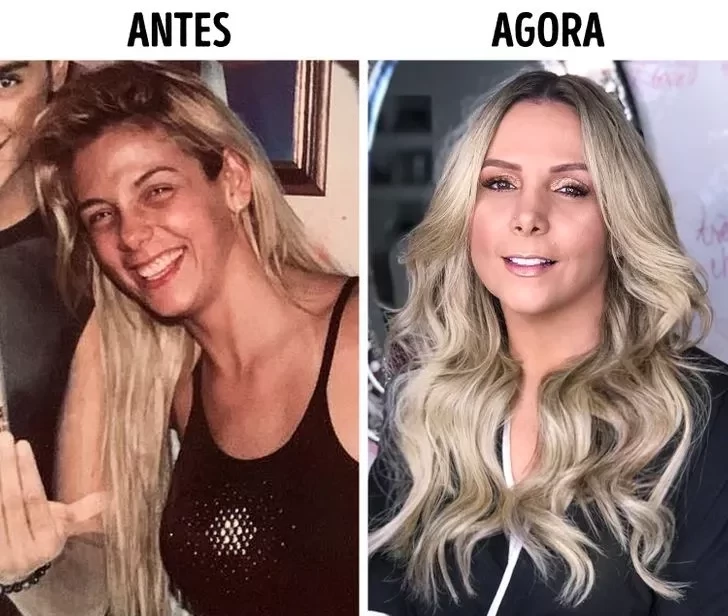 Confira o Antes e Depois das cirurgias plásticas de 15 famosas - imagem 22848