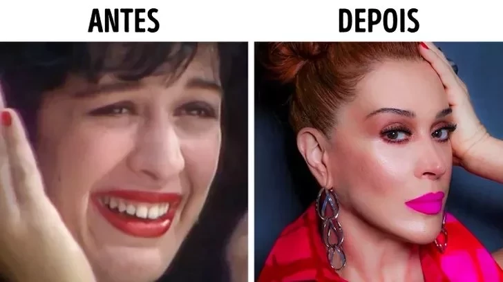 Confira o Antes e Depois das cirurgias plásticas de 15 famosas - imagem 22857