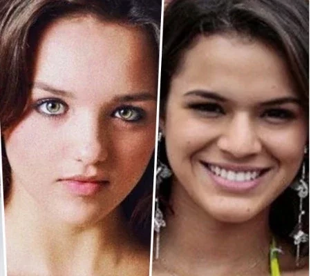 Confira o Antes e Depois das cirurgias plásticas de 15 famosas