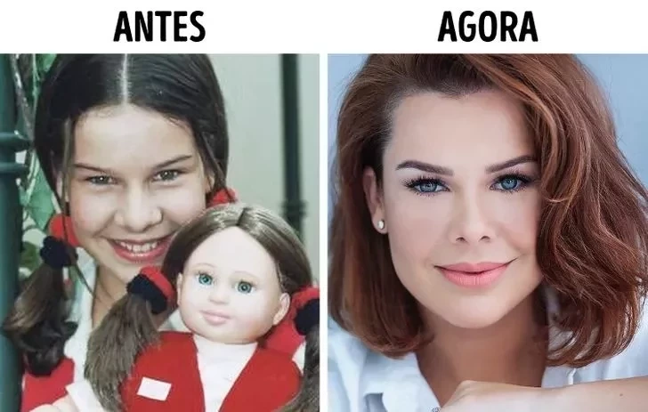 Confira o Antes e Depois das cirurgias plásticas de 15 famosas - imagem 22852