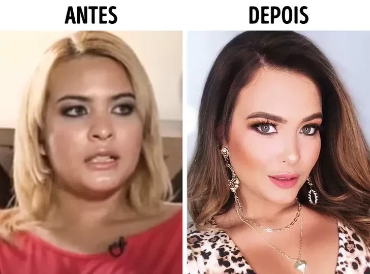 Confira o Antes e Depois das cirurgias plásticas de 15 famosas - imagem 22854