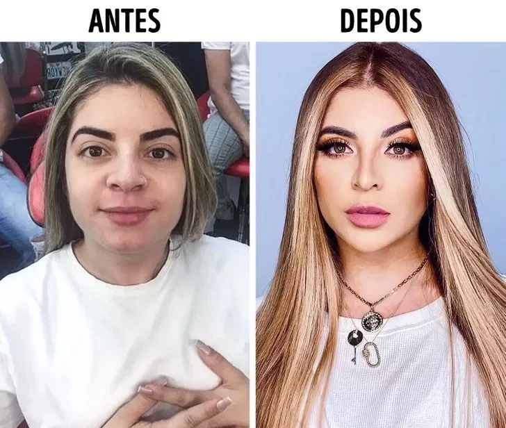 Confira o Antes e Depois das cirurgias plásticas de 15 famosas - imagem 22859