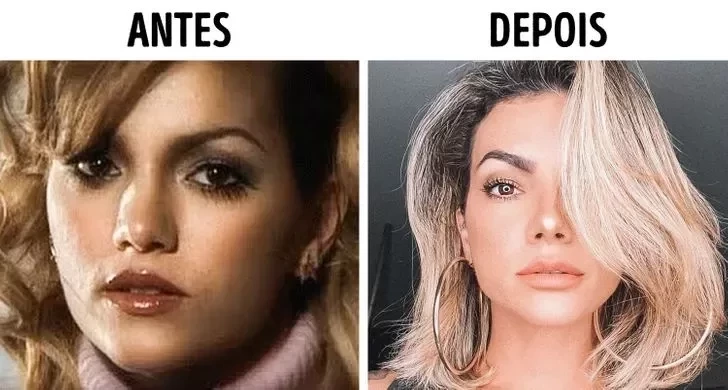 Confira o Antes e Depois das cirurgias plásticas de 15 famosas - imagem 22858