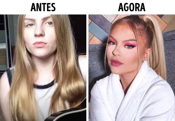 Confira o Antes e Depois das cirurgias plásticas de 15 famosas - imagem 22846