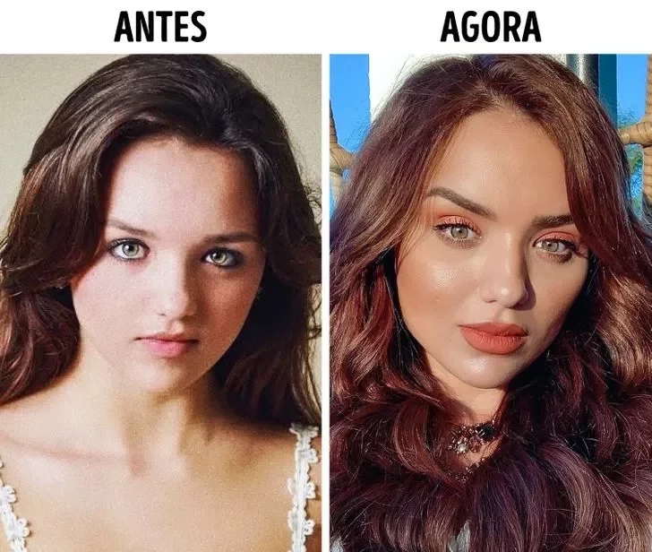 Confira o Antes e Depois das cirurgias plásticas de 15 famosas - imagem 22849