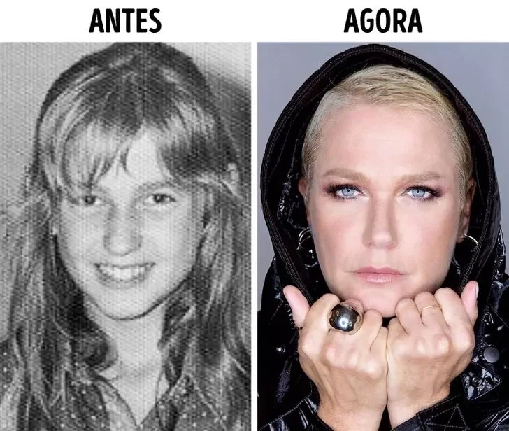 Confira o Antes e Depois das cirurgias plásticas de 15 famosas - imagem 22855