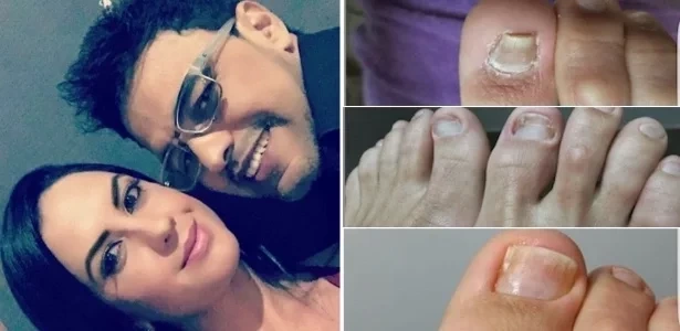 Conheça 10 famosos cujos pés já viraram notícia por serem "feios” - imagem 24661