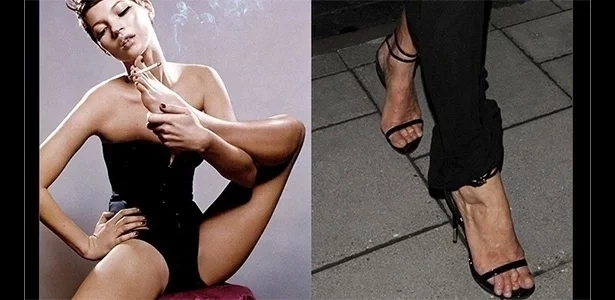 Conheça 10 famosos cujos pés já viraram notícia por serem "feios” - imagem 24670