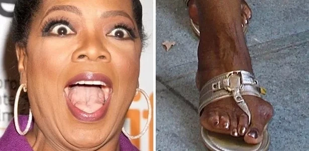Conheça 10 famosos cujos pés já viraram notícia por serem "feios” - imagem 24666