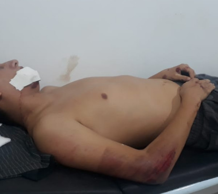 Jovem sofre acidente de moto no interior do Piauí