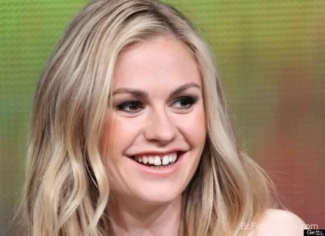 De separados a tortos! Conheça as celebridades com os dentes ruins - imagem 25499