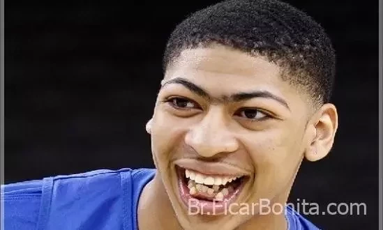 De separados a tortos! Conheça as celebridades com os dentes ruins - imagem 25500