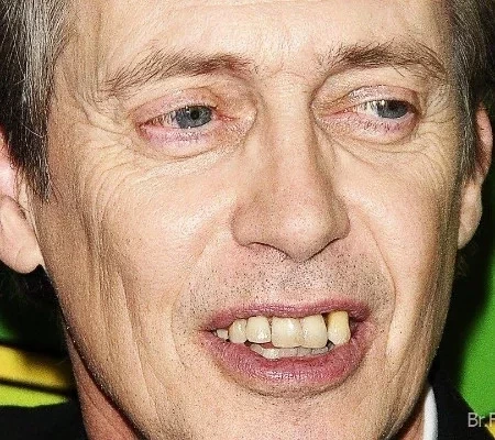 De separados a tortos! Conheça as celebridades com os dentes ruins