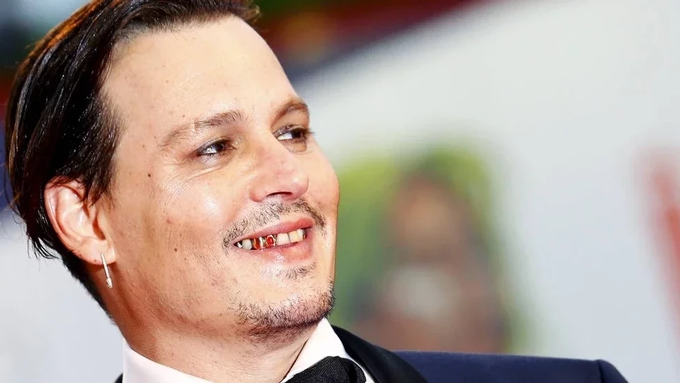 De separados a tortos! Conheça as celebridades com os dentes ruins - imagem 25485