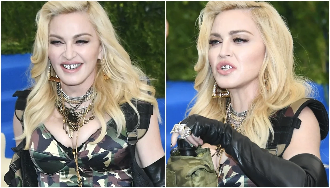 De separados a tortos! Conheça as celebridades com os dentes ruins - imagem 25487