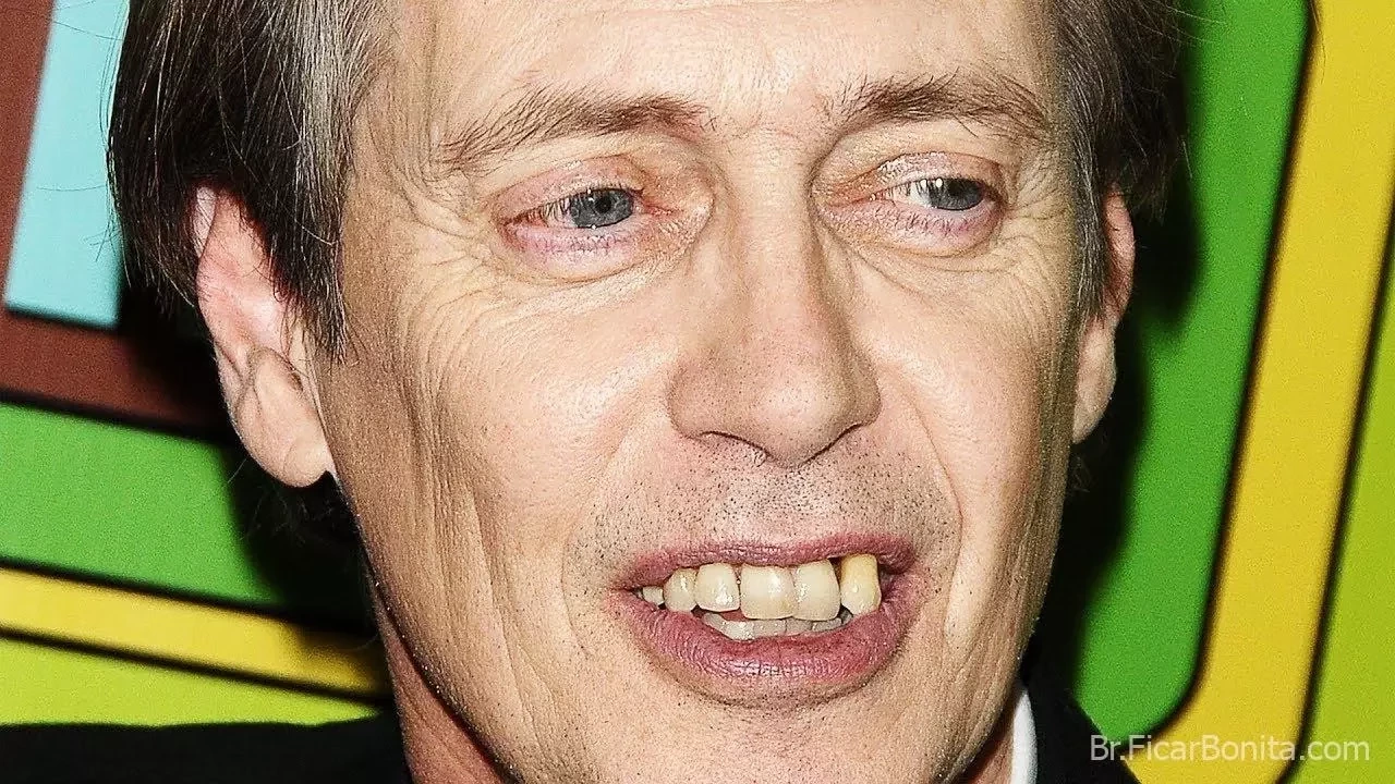 De separados a tortos! Conheça as celebridades com os dentes ruins - imagem 25488