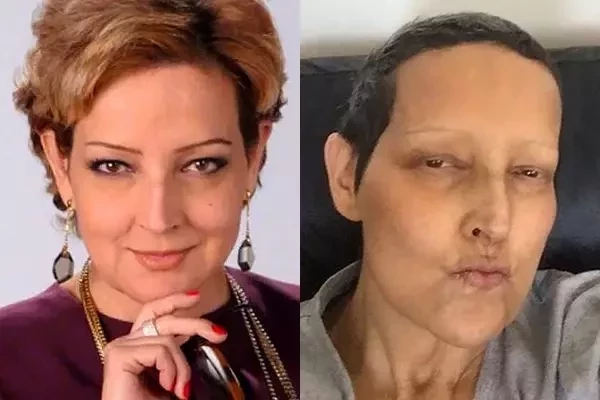 Relembre os atores da novela Uga Uga que já morreram - imagem 24539