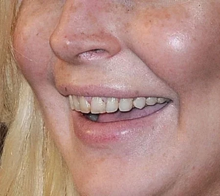 Conheça as celebridades com dentes “fora do padrão”