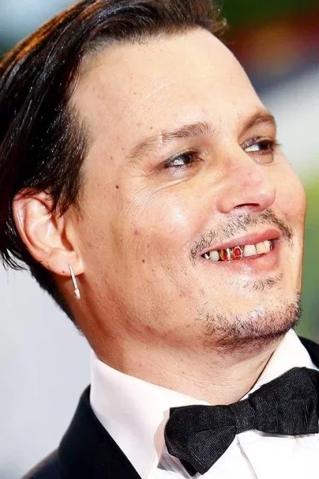 Conheça as celebridades com dentes "fora do padrão" - imagem 26753