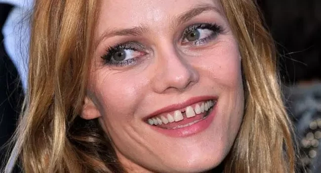 Conheça as celebridades com dentes "fora do padrão" - imagem 26754