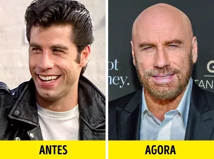 42 anos depois, veja os atores de "Grease - Nos Tempos da Brilhantina" - imagem 26822