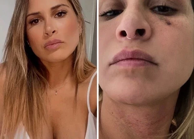 Ex-assistente de palco acusa ex de agressão e relata 'vingança pornô' - imagem 31663