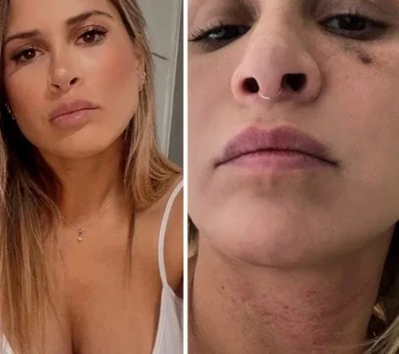 Ex-assistente de palco acusa ex de agressão e relata 'vingança pornô'