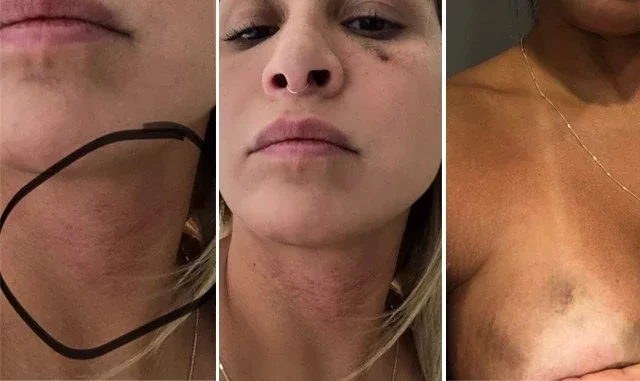 Ex-assistente de palco acusa ex de agressão e relata 'vingança pornô' - imagem 31666