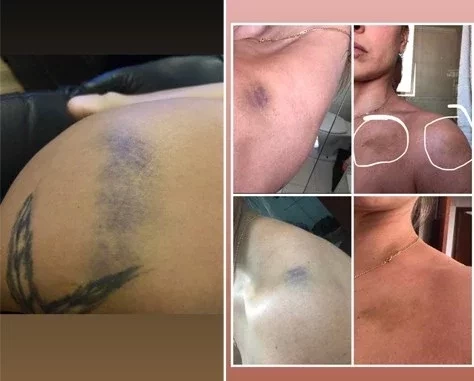 Ex-assistente de palco acusa ex de agressão e relata 'vingança pornô' - imagem 31664