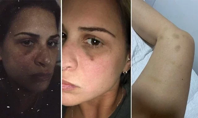 Ex-assistente de palco acusa ex de agressão e relata 'vingança pornô' - imagem 31665