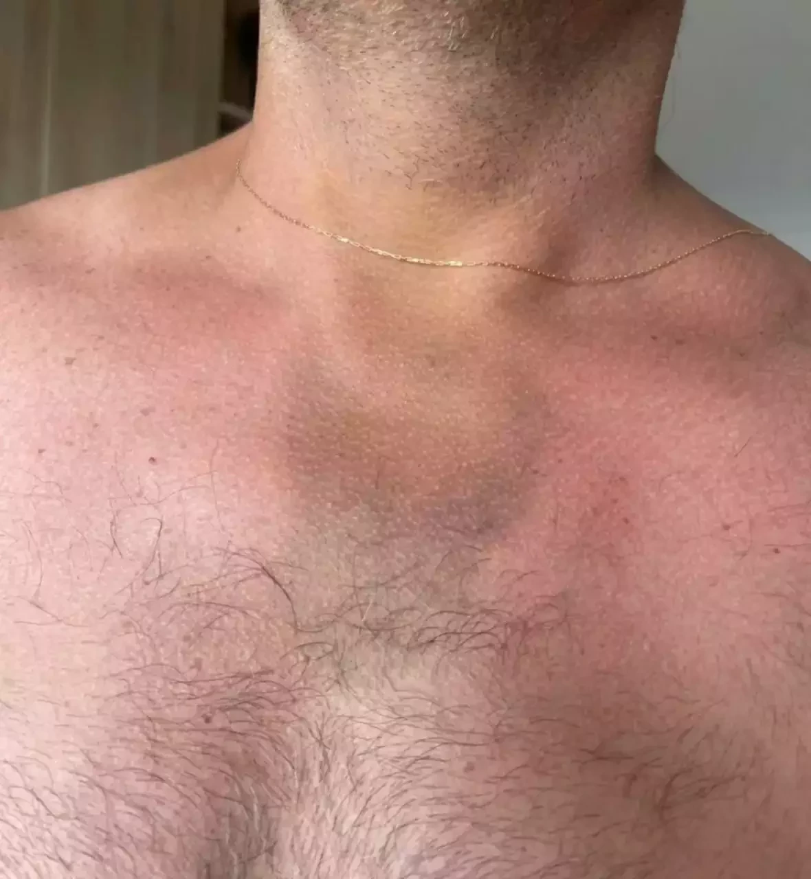 Henri Castelli cai no choro ao denunciar agressão grave em AL; fotos - imagem 31756