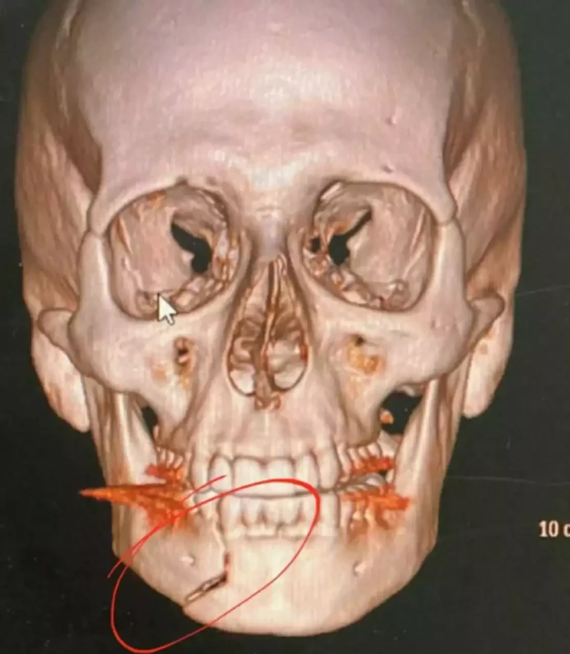 Henri Castelli cai no choro ao denunciar agressão grave em AL; fotos - imagem 31758