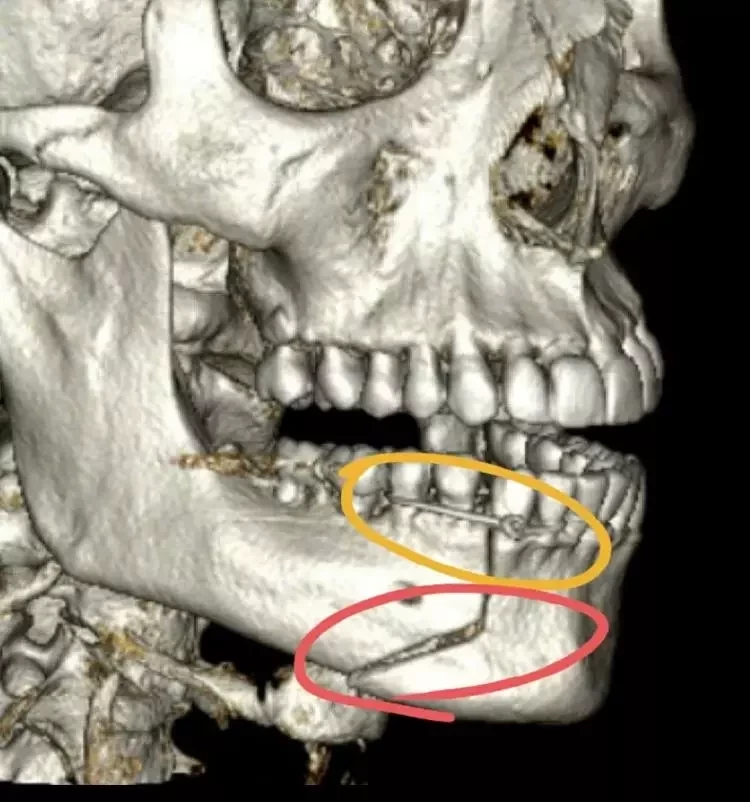 Henri Castelli cai no choro ao denunciar agressão grave em AL; fotos - imagem 31759