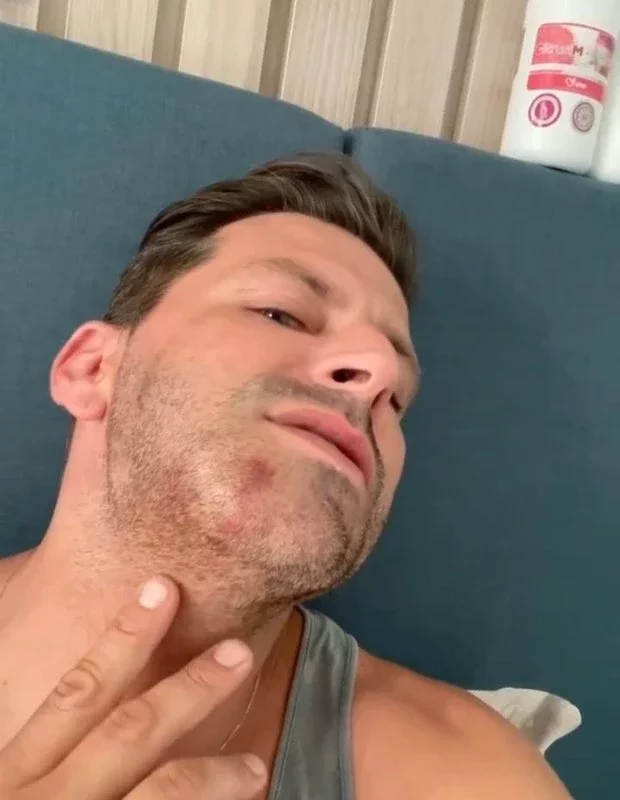 Henri Castelli cai no choro ao denunciar agressão grave em AL; fotos - imagem 31760