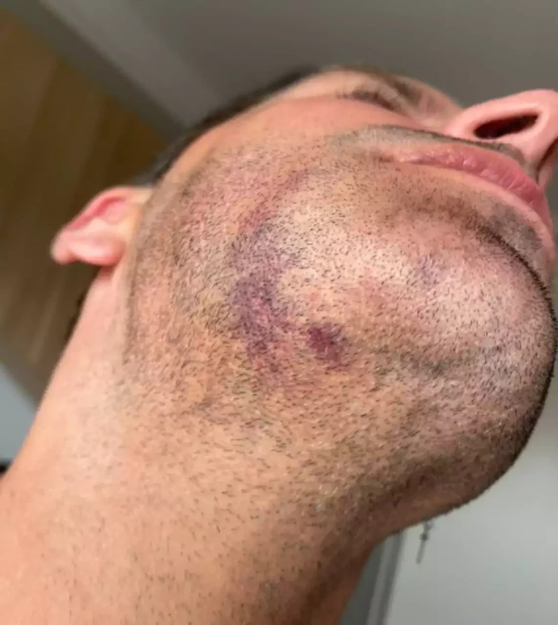 Henri Castelli cai no choro ao denunciar agressão grave em AL; fotos - imagem 31757