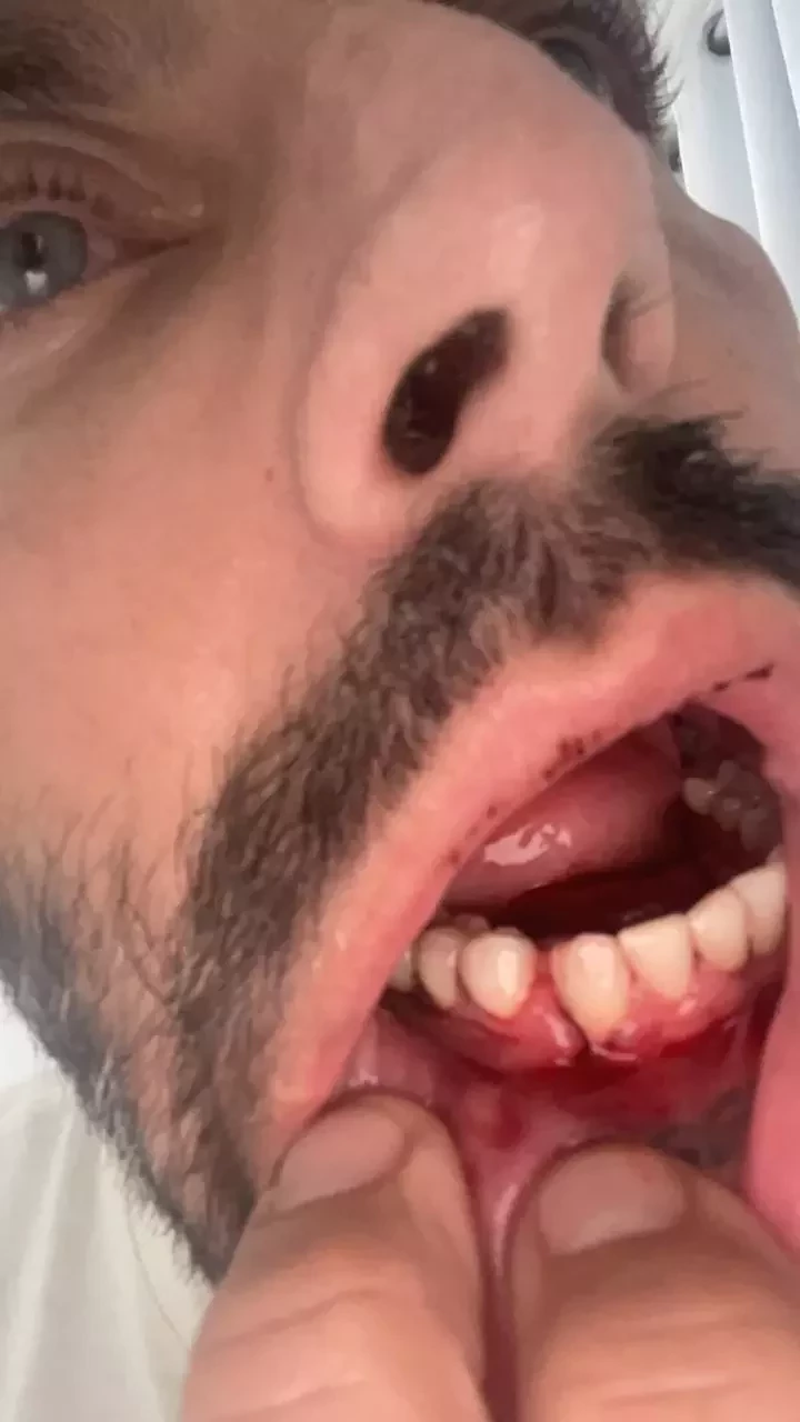 Henri Castelli cai no choro ao denunciar agressão grave em AL; fotos - imagem 31755