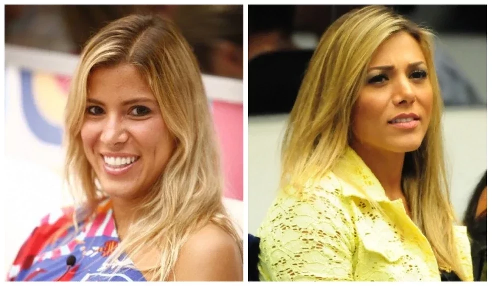 Separados na maternidade? Conheça os ex-BBBs que podem até ser sósias - imagem 32521