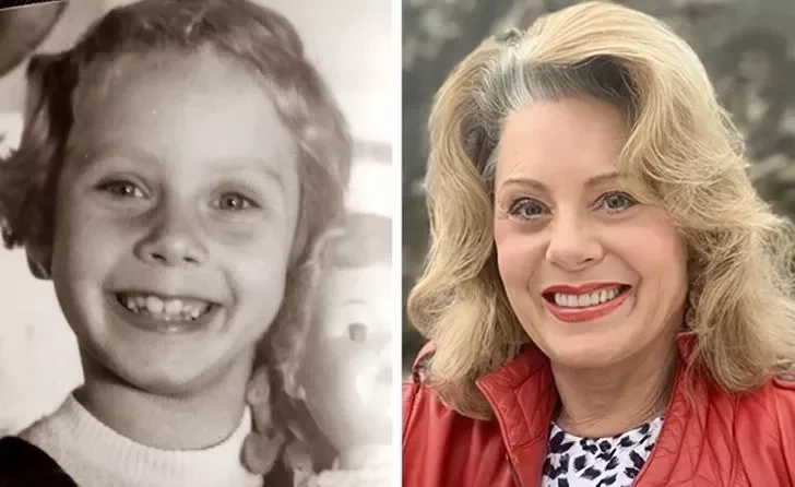 Antes e depois de 10 musas que se tornaram ícones de beleza no Brasil - imagem 31464